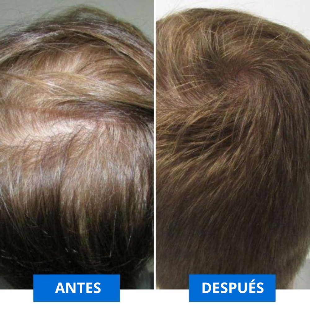 Capilzen – Tu Ritual de Belleza para Revivir tu Melena